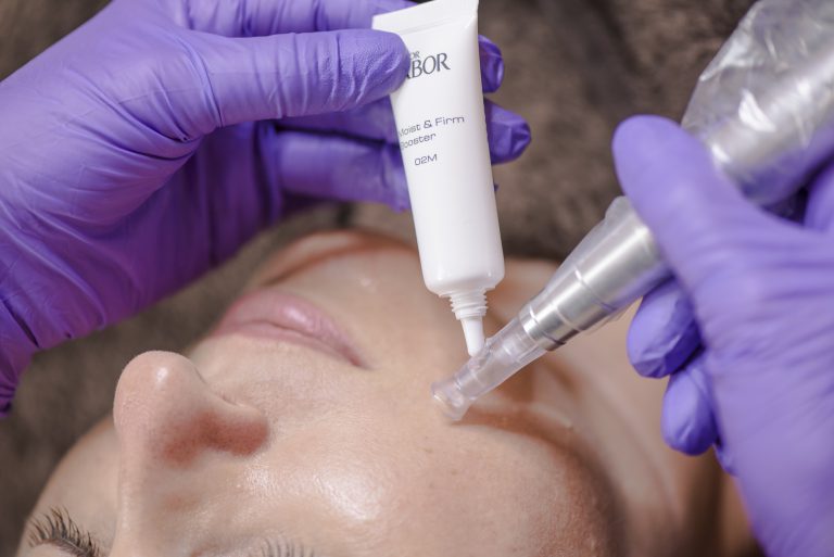 Bald ist wieder Micro Needling Zeit – Bereite deine Haut jetzt schon darauf vor