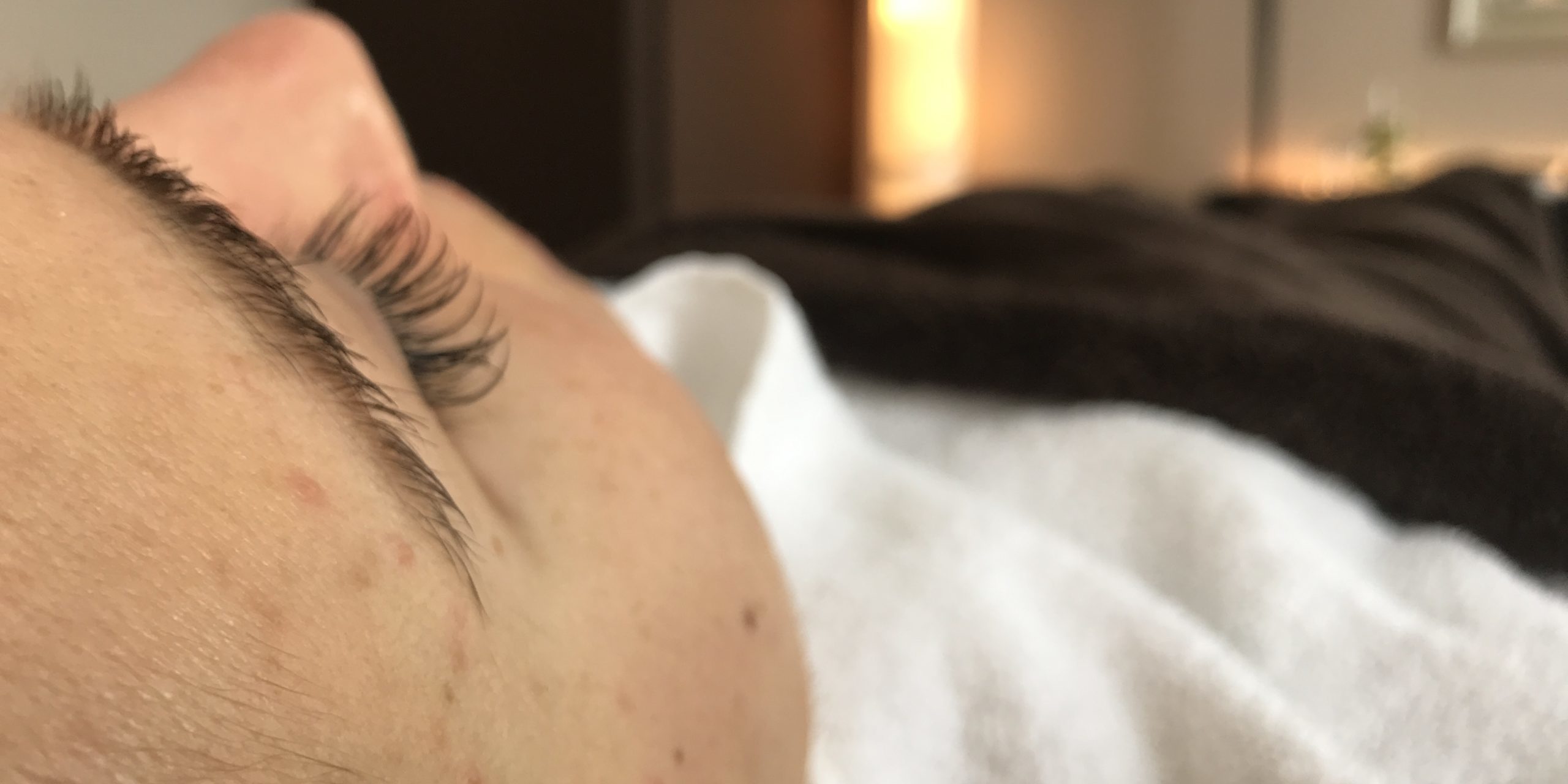 Peeling_bei-unreiner_Haut