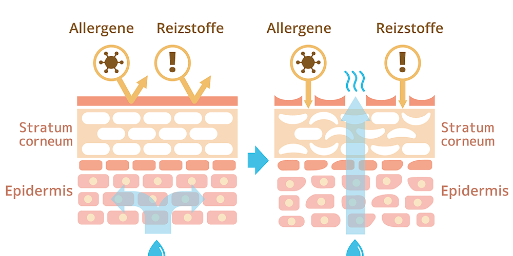 Hautschema-Feuchtigkeit-Hautbarriere
