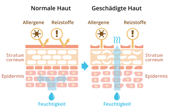 Hautschema-Feuchtigkeit-Hautbarriere